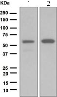 Western blot - Anti-GRK1 antibody [EPR2039(2)] (AB108502), expandable thumbnail