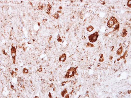 Immunohistochemistry (Formalin/PFA-fixed paraffin-embedded sections) - Anti-GRK2 antibody (AB228705)