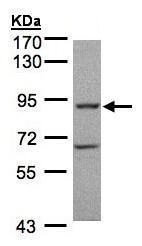 Western blot - Anti-GRK2 antibody (AB228705), expandable thumbnail