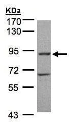 Western blot - Anti-GRK2 antibody (AB228705)