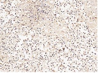 Immunohistochemistry (Formalin/PFA-fixed paraffin-embedded sections) - Anti-GRK2 antibody (AB235240)