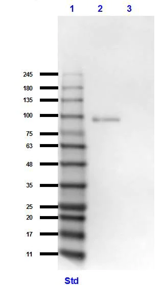 Western blot - Anti-GRK2 antibody (AB235240)