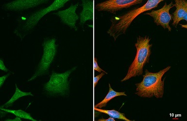 Immunocytochemistry/ Immunofluorescence - Anti-GRK2 antibody - C-terminal (AB137666)