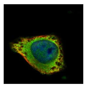 Immunocytochemistry/ Immunofluorescence - Anti-GRK2 antibody - C-terminal (AB137666)