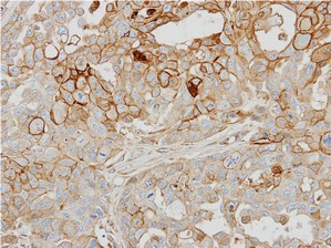 Immunohistochemistry (Formalin/PFA-fixed paraffin-embedded sections) - Anti-GRK2 antibody - C-terminal (AB137666)