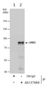 Immunoprecipitation - Anti-GRK2 antibody - C-terminal (AB137666)