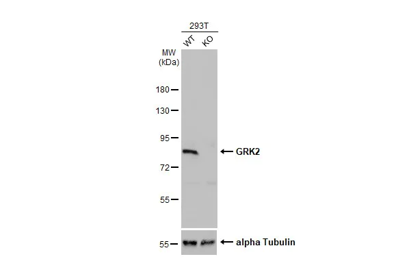 Western blot - Anti-GRK2 antibody - C-terminal (AB137666)