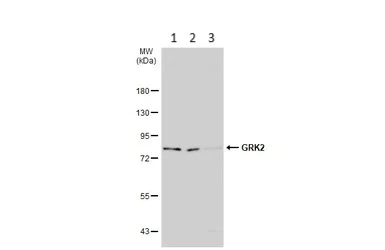 Western blot - Anti-GRK2 antibody - C-terminal (AB137666)