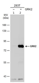 Western blot - Anti-GRK2 antibody - C-terminal (AB137666)