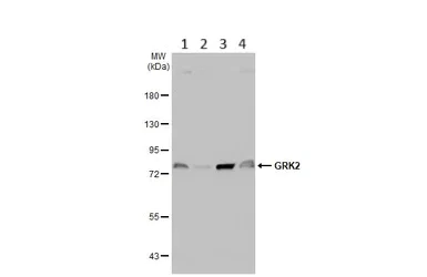 Western blot - Anti-GRK2 antibody - C-terminal (AB137666)