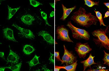 Immunocytochemistry/ Immunofluorescence - Anti-GRK2 antibody [HL1562] (AB308172)