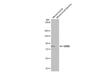 Western blot - Anti-GRK2 antibody [HL1562] (AB308172)