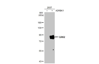 Western blot - Anti-GRK2 antibody [HL1562] (AB308172)