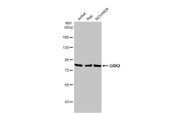Western blot - Anti-GRK2 antibody [HL1562] (AB308172)