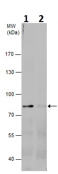Western blot - Anti-GRK2 (phospho S670) antibody (AB229645)
