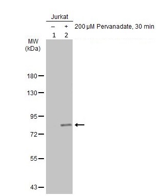 Western blot - Anti-GRK2 (phospho S670) antibody (AB229645)