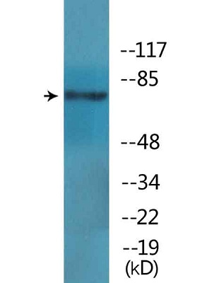 Western blot - Anti-GRK2 (phospho S685) antibody (AB138438)