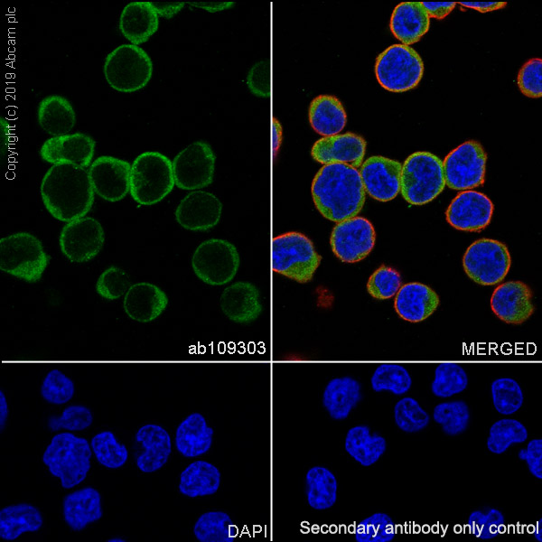 Anti-GRK3 antibody [EPR2041(2)] (ab109303) | Abcam