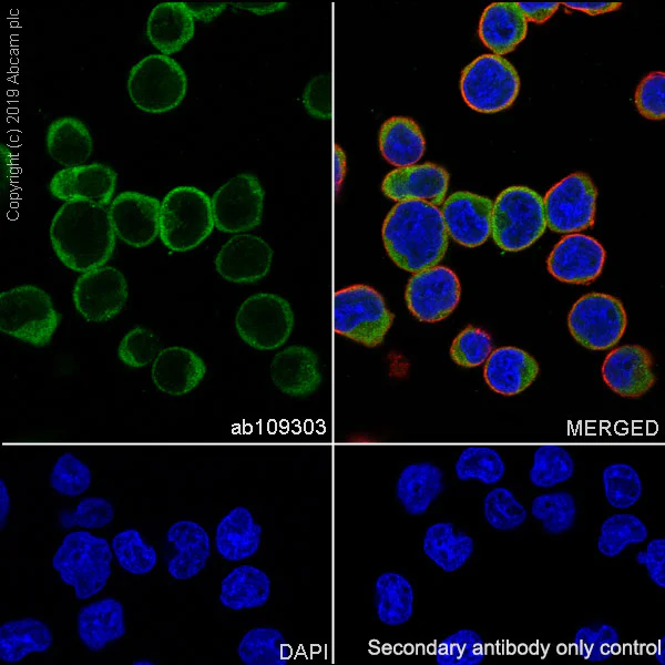 Immunocytochemistry/ Immunofluorescence - Anti-GRK3 antibody [EPR2041(2)] (AB109303)