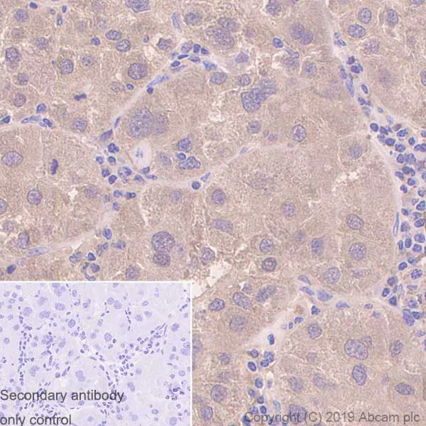 Immunohistochemistry (Formalin/PFA-fixed paraffin-embedded sections) - Anti-GRK3 antibody [EPR2041(2)] (AB109303)
