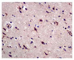 Immunohistochemistry (Formalin/PFA-fixed paraffin-embedded sections) - Anti-GRK3 antibody [EPR2041(2)] (AB109303)