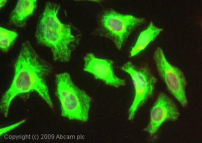 Immunocytochemistry/ Immunofluorescence - Anti-GRK5 antibody (AB64943)