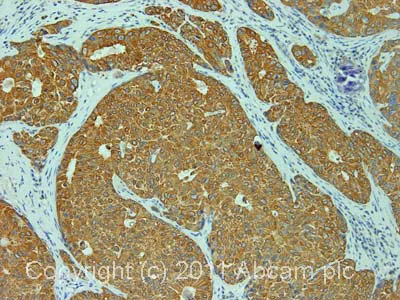 Immunohistochemistry (Formalin/PFA-fixed paraffin-embedded sections) - Anti-GRK5 antibody (AB64943)