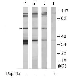 Western blot - Anti-GRK5 antibody (AB64943)