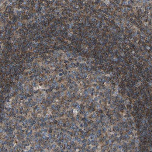 Immunohistochemistry (Formalin/PFA-fixed paraffin-embedded sections) - Anti-GRK6 antibody (AB244364), expandable thumbnail