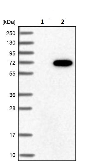 Western blot - Anti-GRK6 antibody (AB244364), expandable thumbnail