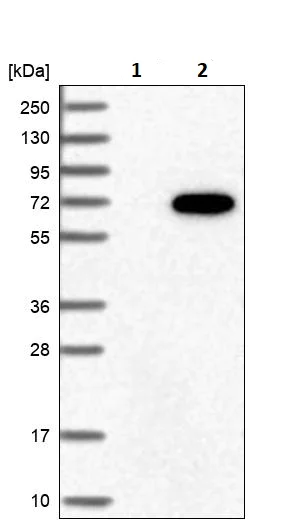 Western blot - Anti-GRK6 antibody (AB244364)