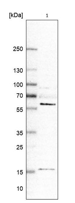 Western blot - Anti-GRK6 antibody (AB244364), expandable thumbnail