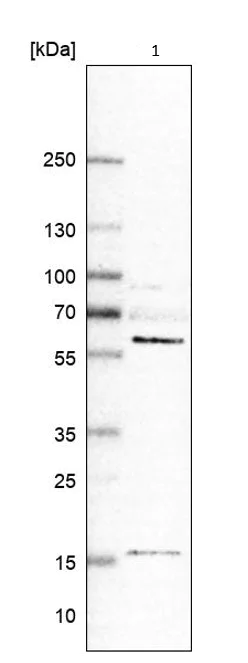 Western blot - Anti-GRK6 antibody (AB244364)