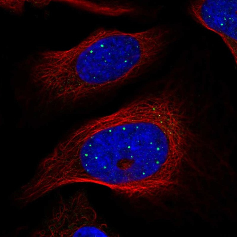 Immunocytochemistry/ Immunofluorescence - Anti-GRLF1 antibody (AB247123), expandable thumbnail