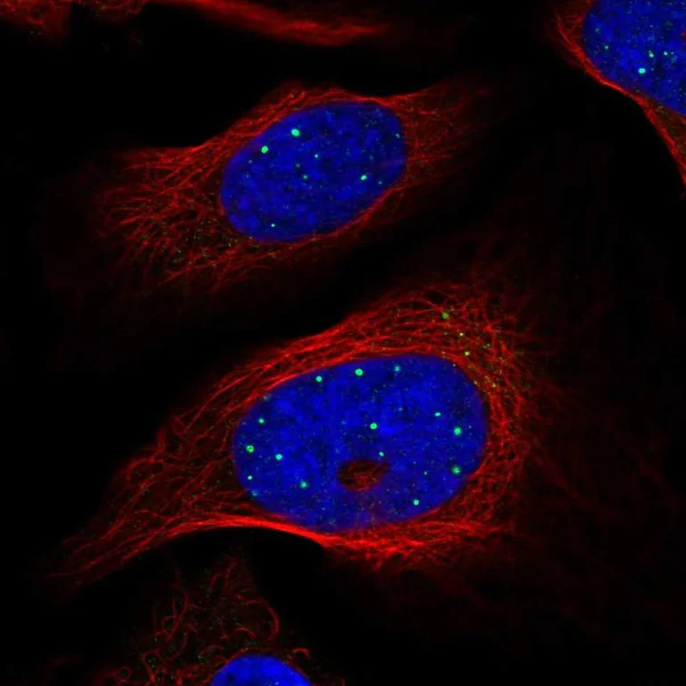 Immunocytochemistry/ Immunofluorescence - Anti-GRLF1 antibody (AB247123)