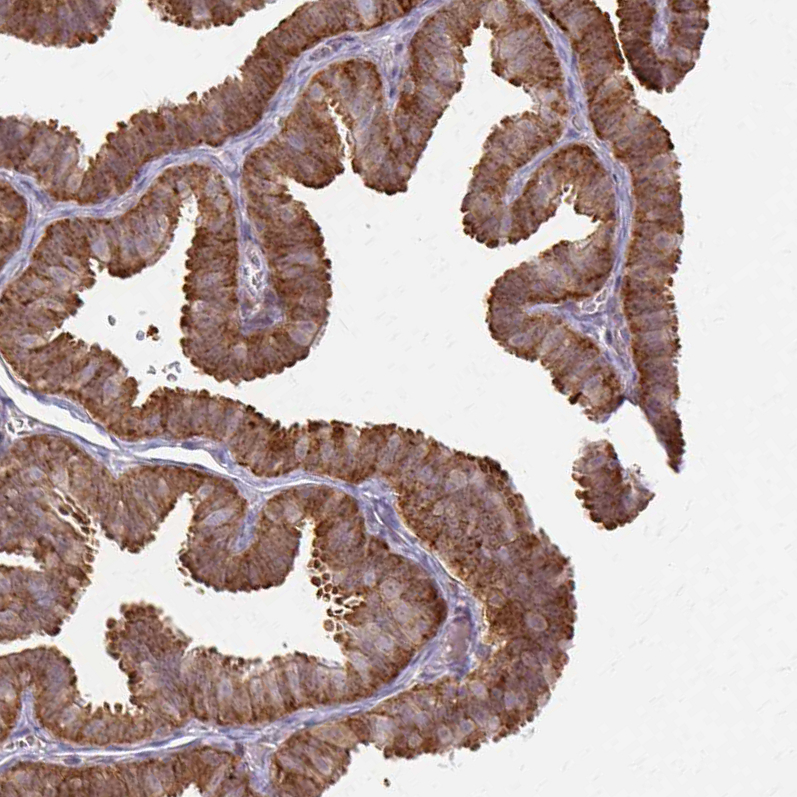 Immunohistochemistry (Formalin/PFA-fixed paraffin-embedded sections) - Anti-GRLF1 antibody (AB247123), expandable thumbnail