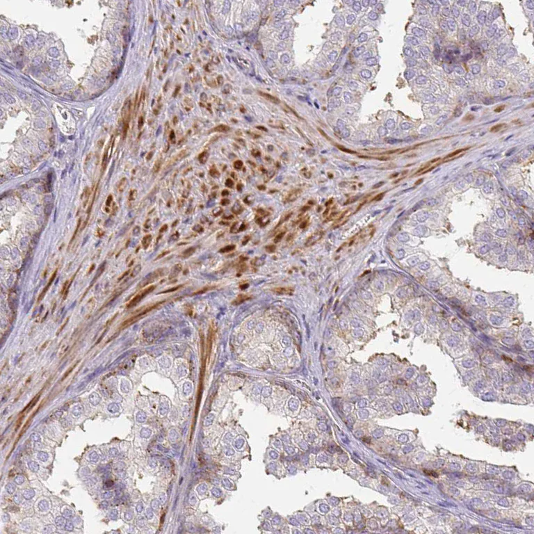 Immunohistochemistry (Formalin/PFA-fixed paraffin-embedded sections) - Anti-GRLF1 antibody (AB247123)
