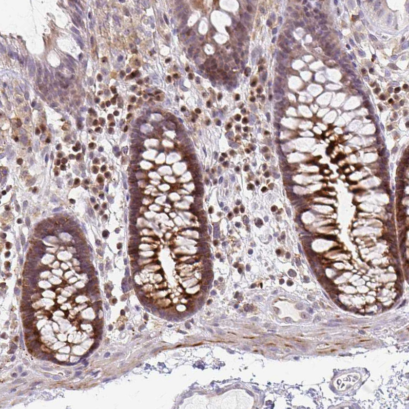Immunohistochemistry (Formalin/PFA-fixed paraffin-embedded sections) - Anti-GRLF1 antibody (AB247123), expandable thumbnail