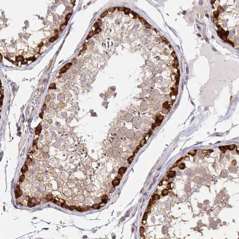 Immunohistochemistry (Formalin/PFA-fixed paraffin-embedded sections) - Anti-GRLF1 antibody (AB247123)
