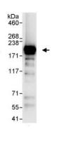 Immunoprecipitation - Anti-GRLF1 antibody (AB85950)