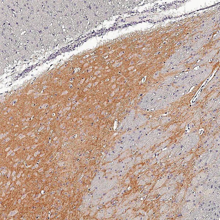 Immunohistochemistry (Formalin/PFA-fixed paraffin-embedded sections) - Anti-GRM5 antibody [HL2543] - BSA and Azide free (AB325866)
