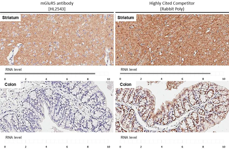 Immunohistochemistry (Formalin/PFA-fixed paraffin-embedded sections) - Anti-GRM5 antibody [HL2543] - BSA and Azide free (AB325866)