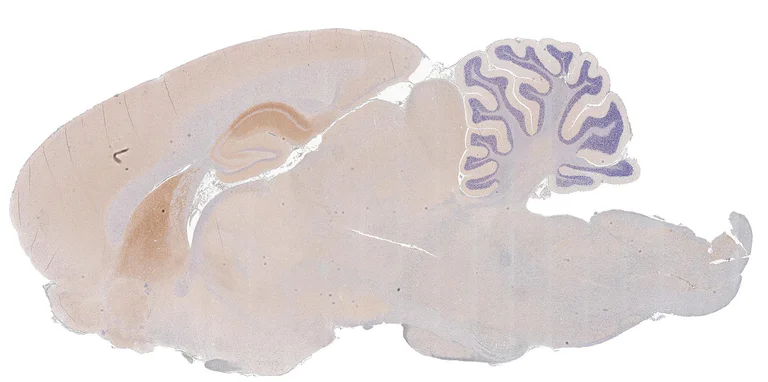 Immunohistochemistry (Formalin/PFA-fixed paraffin-embedded sections) - Anti-GRM5 antibody [HL2543] - BSA and Azide free (AB325866)