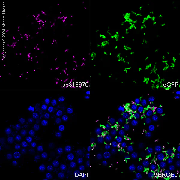 Immunocytochemistry/ Immunofluorescence - Anti-groEL antibody [EPR28718-8] (AB318970)