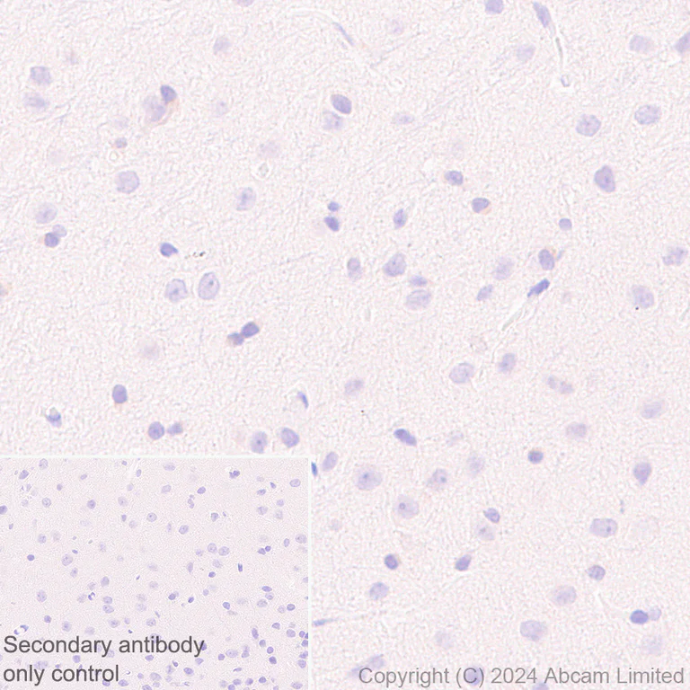 Immunohistochemistry (Formalin/PFA-fixed paraffin-embedded sections) - Anti-groEL antibody [EPR28718-8] (AB318970)