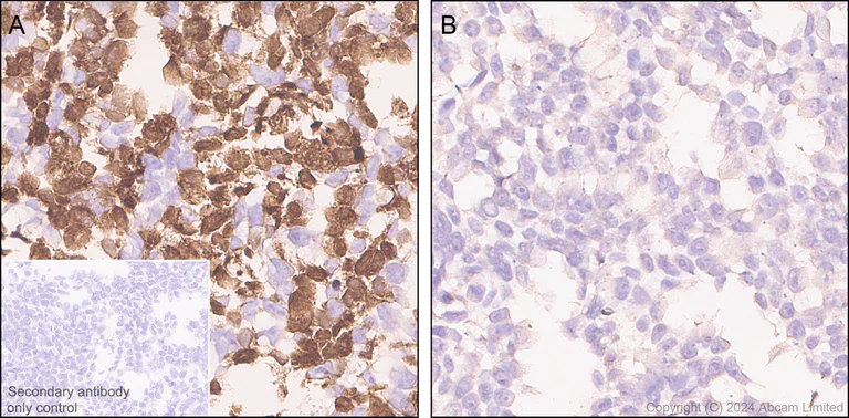 Immunohistochemistry (Formalin/PFA-fixed paraffin-embedded sections) - Anti-groEL antibody [EPR28718-8] - BSA and Azide free (AB318971)