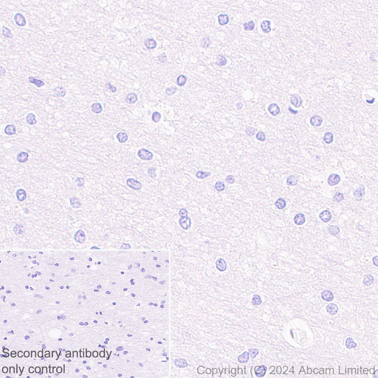 Immunohistochemistry (Formalin/PFA-fixed paraffin-embedded sections) - Anti-groEL antibody [EPR28718-8] - BSA and Azide free (AB318971)