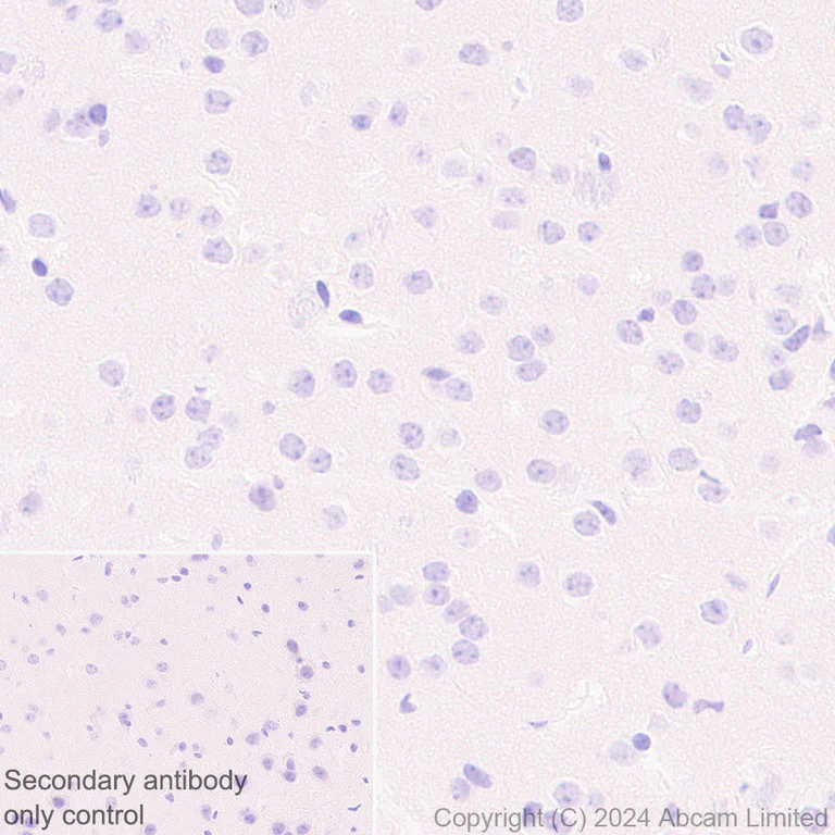 Immunohistochemistry (Formalin/PFA-fixed paraffin-embedded sections) - Anti-groEL antibody [EPR28718-8] - BSA and Azide free (AB318971)