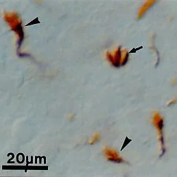 Immunohistochemistry (Formalin/PFA-fixed paraffin-embedded sections) - Anti-Growth Cone antibody [2G13] (AB7762)