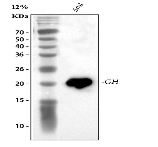 Western blot - Anti-Growth Hormone antibody (AB126882), expandable thumbnail